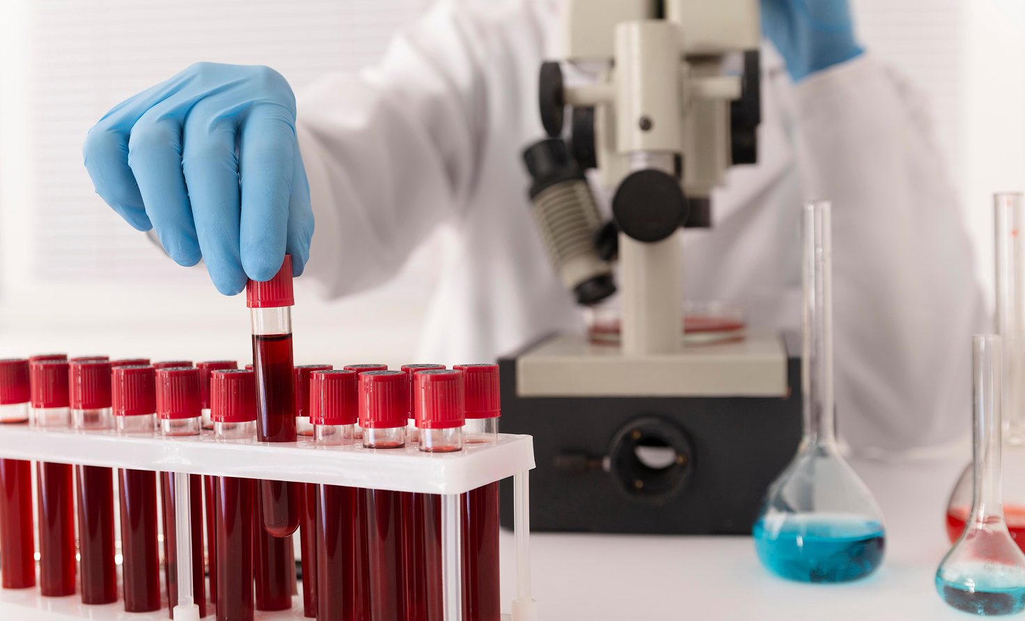 Сывороточное железо: норма железа в крови и анализ | ВитаФерр